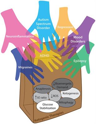 Bringing nutritional ketosis to the table as an option for healing the pediatric brain